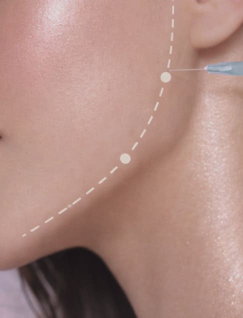 JAW SLIMMING