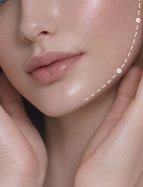 JAW SLIMMING INJECTION