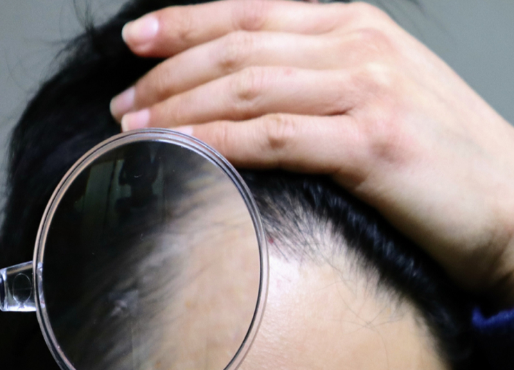 case2のイメージ画像