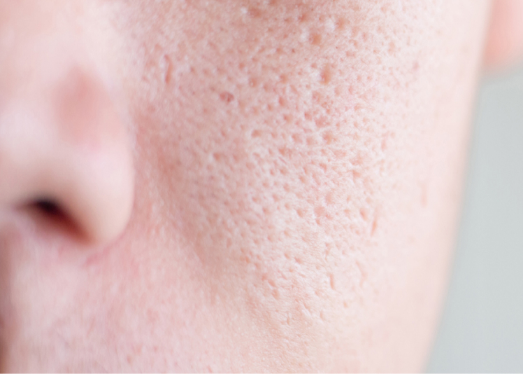 case2のイメージ画像