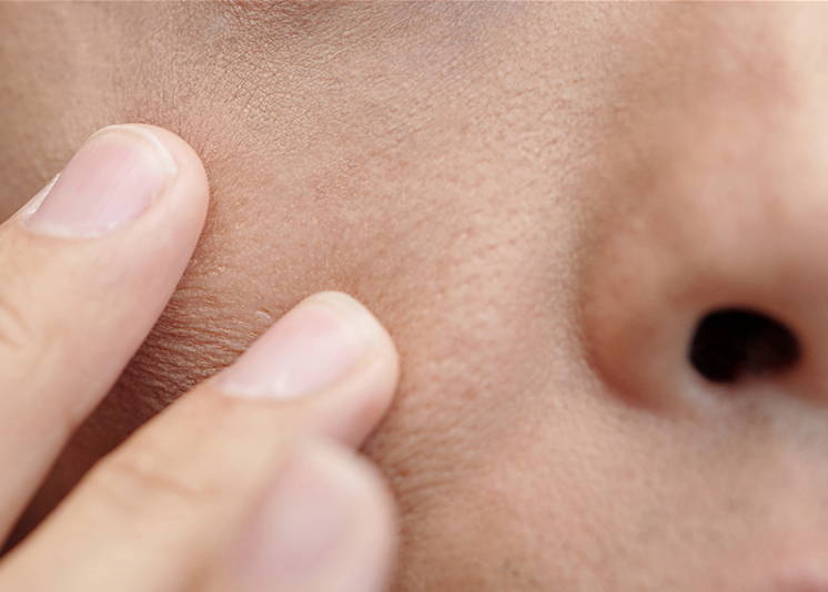 case3のイメージ画像