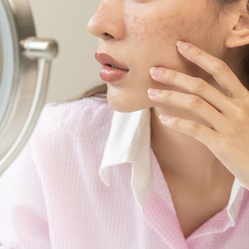 メラニンの蓄積以外にもさまざまな原因が考えられる