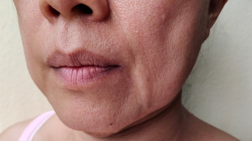 ボリュームダウン型