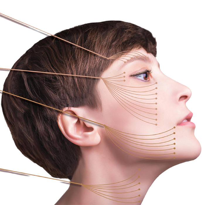 独自の『デザイニング糸リフト』で悩みに合わせた施術を提案