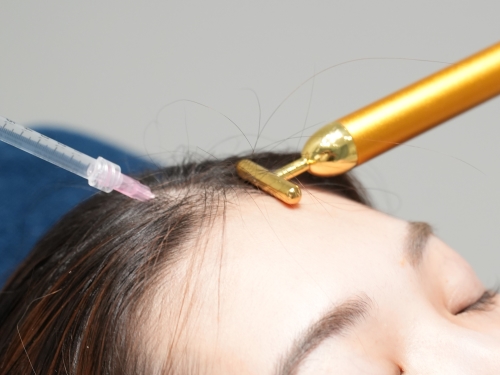 薄毛・AGA治療にも！経験豊富な医師による施術で発毛・育毛を促進