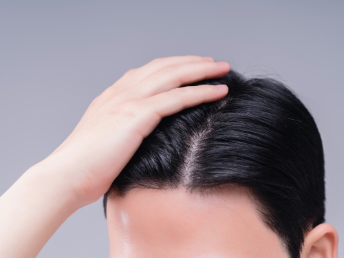 Prevention of Hair Loss and Expected Effects on Hair Growth, Regrowth, and Thickening