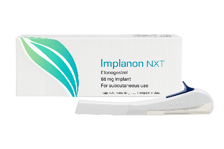 避妊インプラント