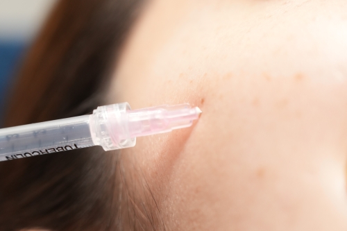 Targeted injections to address various concerns such as wrinkles, sagging, and hair growth promotion<br />&nbsp;