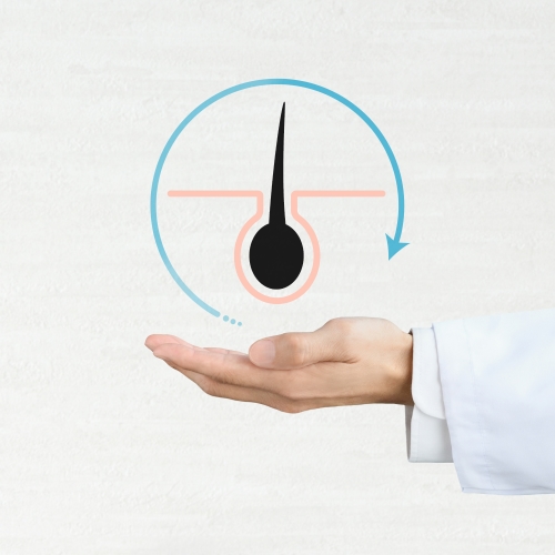 The Cause of AGA Is Disruption of the Hair Growth Cycle Due to Genetics and Male Hormones<br>&nbsp;