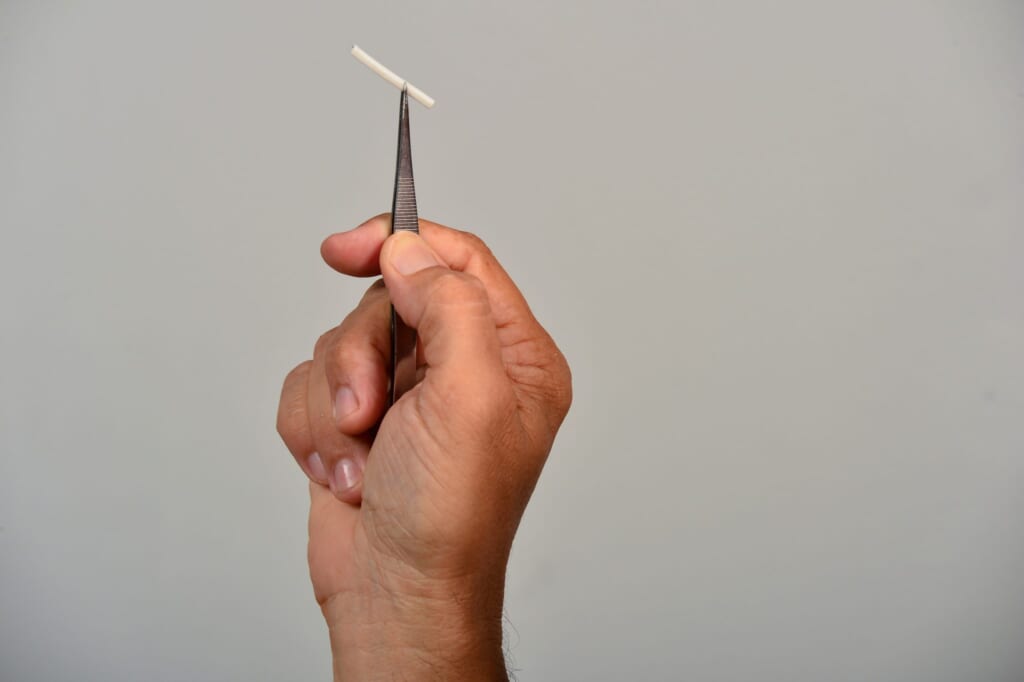 避妊インプラント挿入