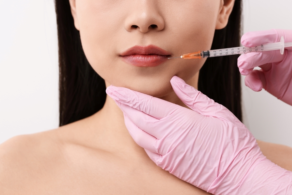 Botox injections at the corners of the mouth to improve the impression of your smile! Bangkok Bibi Clinic's Commitment to Achieving Natural and Gentle Facial Expressions｜Natural Profile Achieved by Bibi Clinic in Bangkok, Thailand