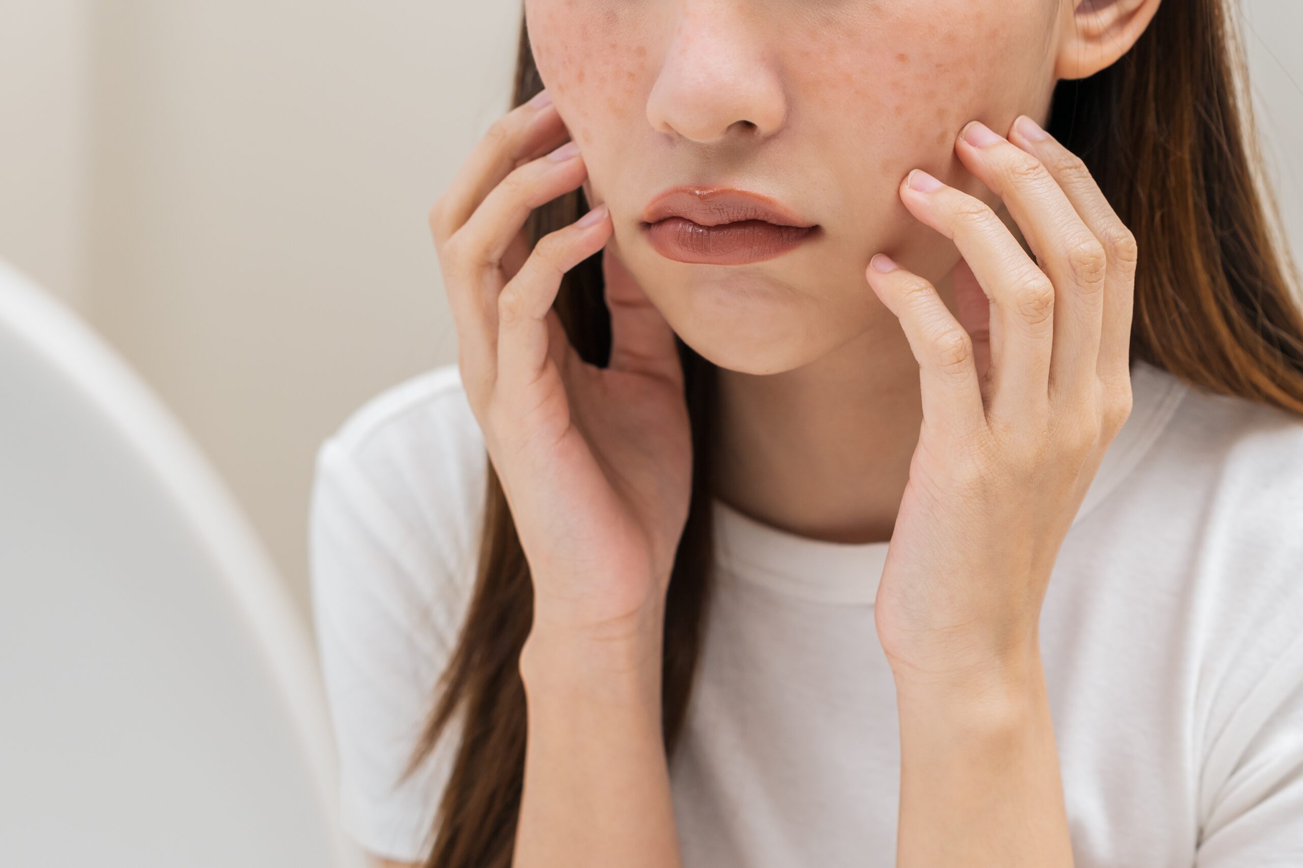 タイでシミ取りがおすすめの理由は？先進デバイス×豊富な症例で効果を追求｜Bibi Clinic｜ビビクリニック｜タイ・バンコクの美容クリニック