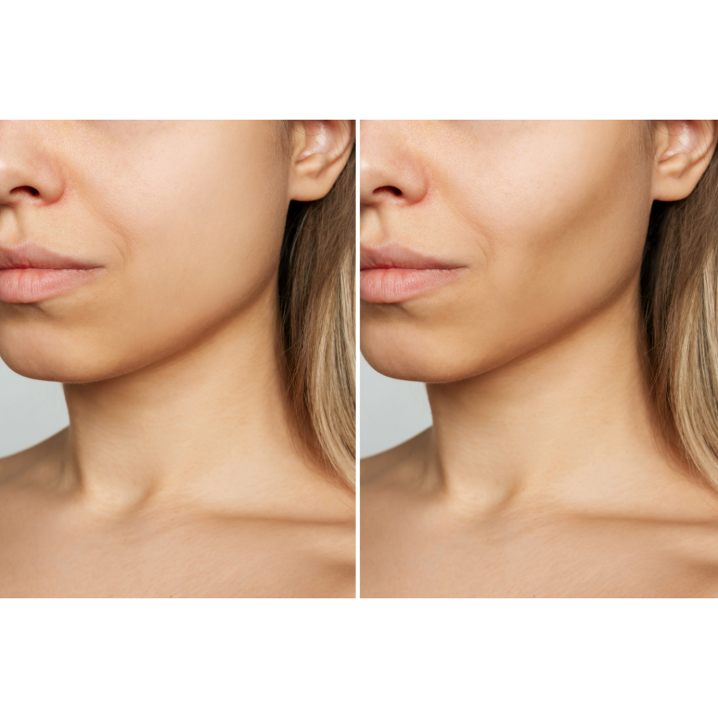 แก้มตอบ