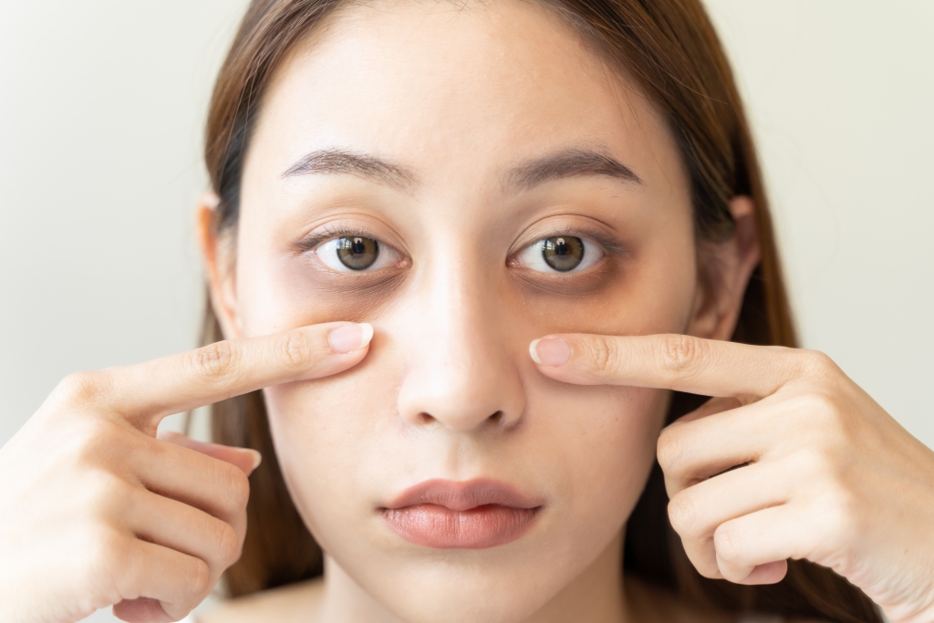 黒クマにより疲れた印象に