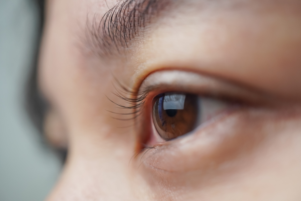 ถุงใต้ตา