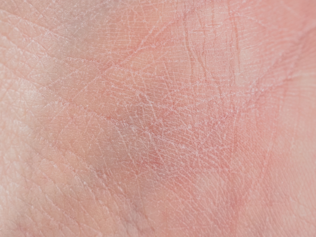 弾力低下・ハリ不足