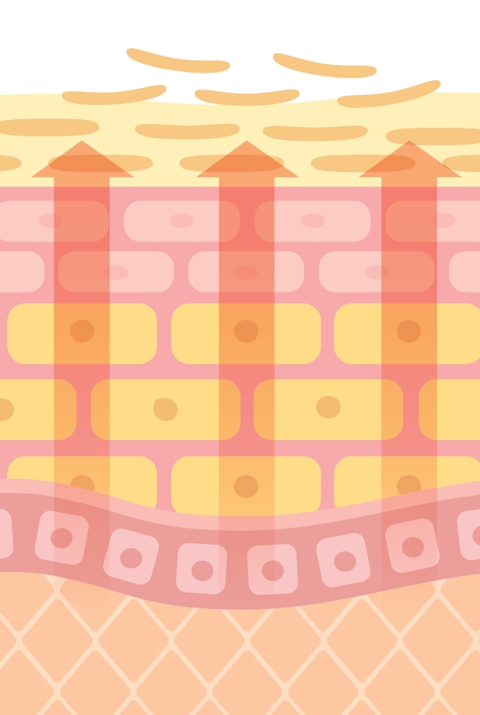 Accumulation of keratin due to disturbed turnover