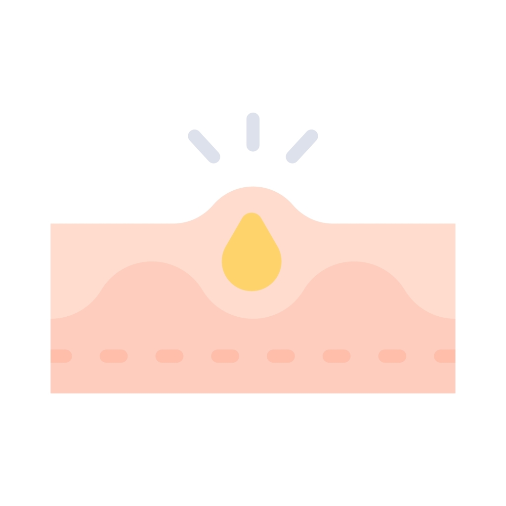 Clogged pores due to excessive sebum secretion