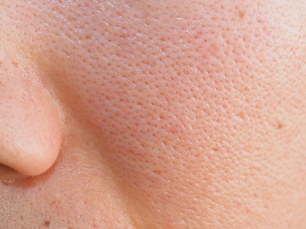 皮脂分泌タイプ