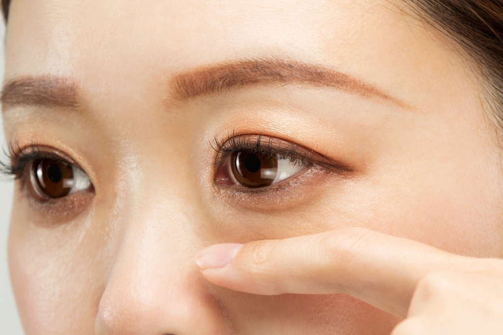 加齢に伴って眼窩脂肪（がんかしぼう）が押し出される