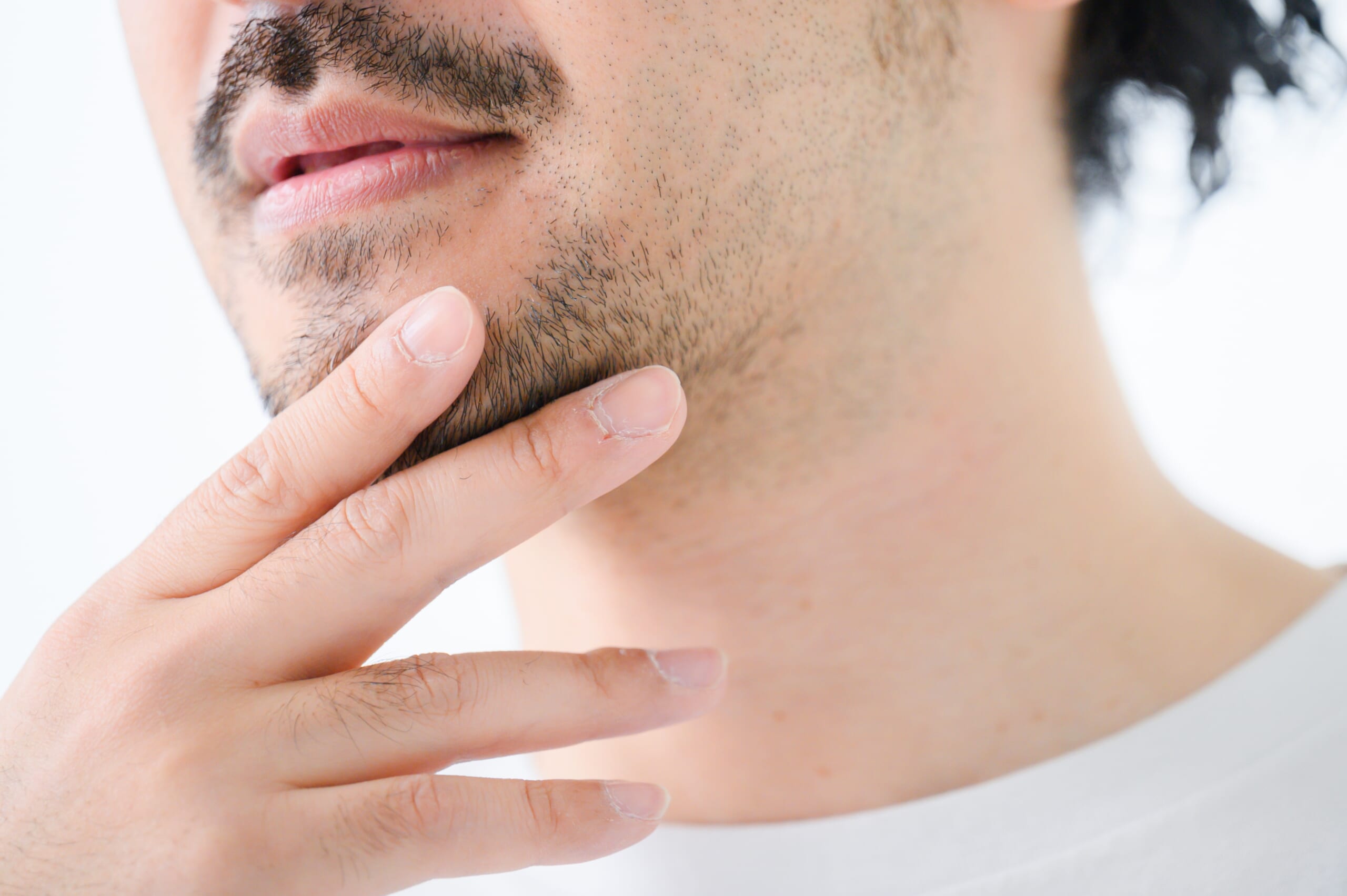 男性 ひげ バンコクでメンズ脱毛をしたいあなたに!タイの紫外線に負けない清潔感と肌質改善を医療脱毛で叶える|Bibi Clinic|ビビクリニック|タイ・バンコクの美容クリニック