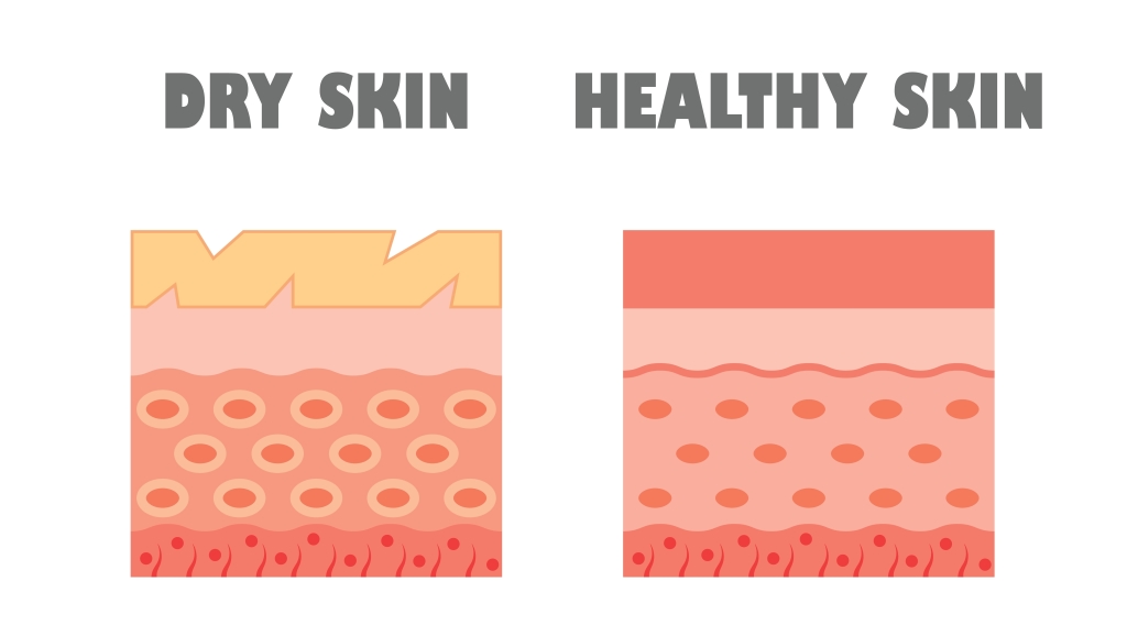 乾燥による毛穴の目立ち