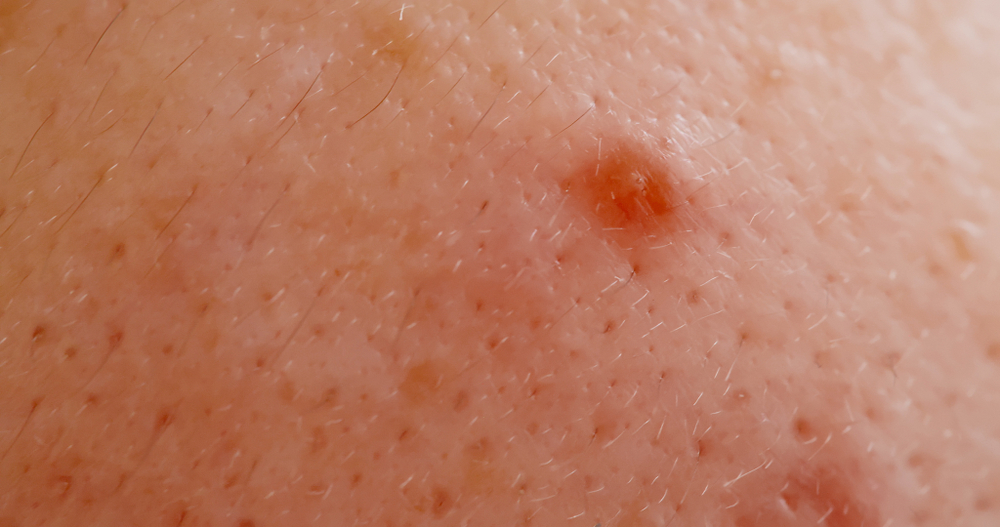 peach fuzz type