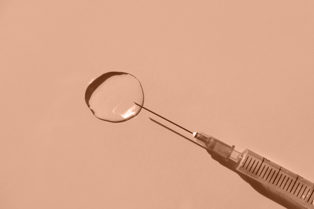 Close-up of syringe and dermal filler used in professional Jawline Filler aesthetic procedures