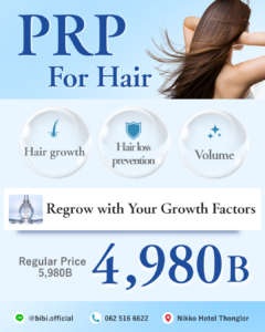PRP treatment