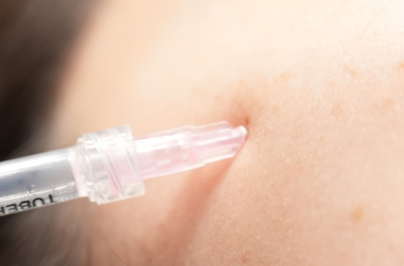 FAT-DISSOLVING INJECTIONS (MESOFAT)