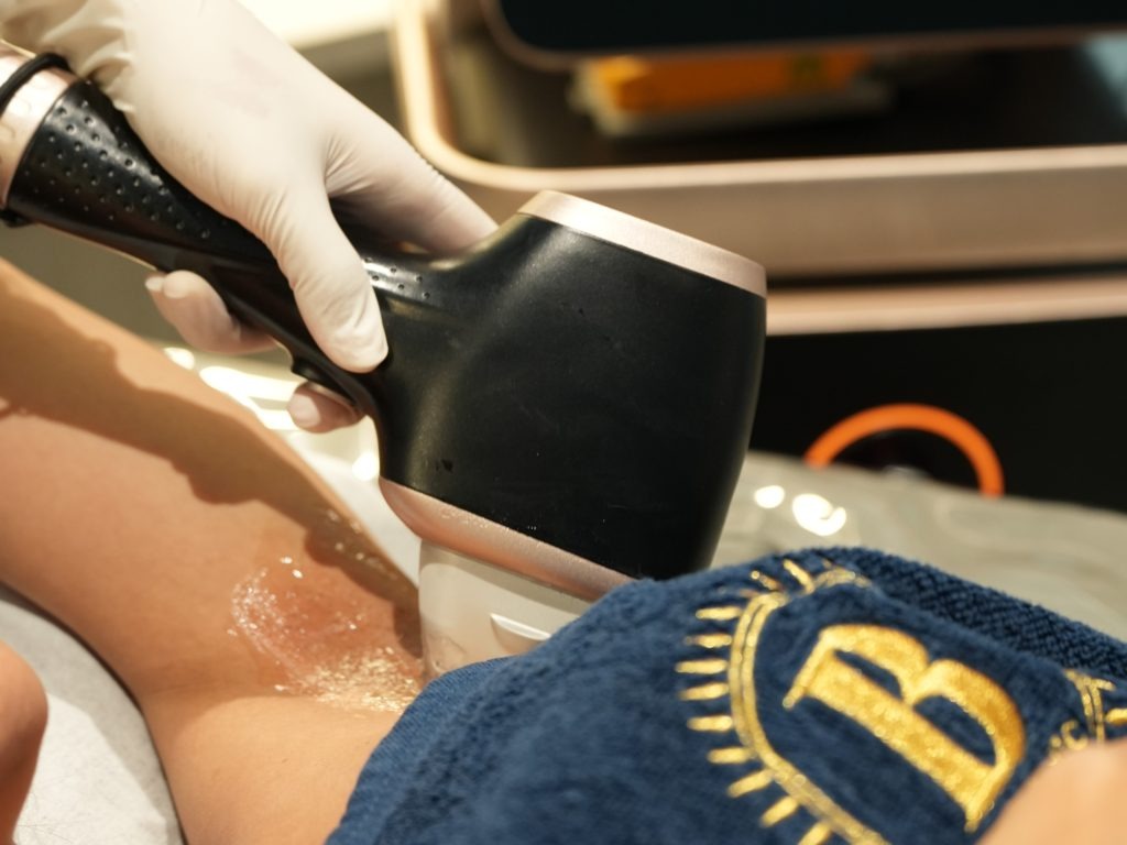 Hair removal treatment procedure at Bibi Clinic Bangkok
