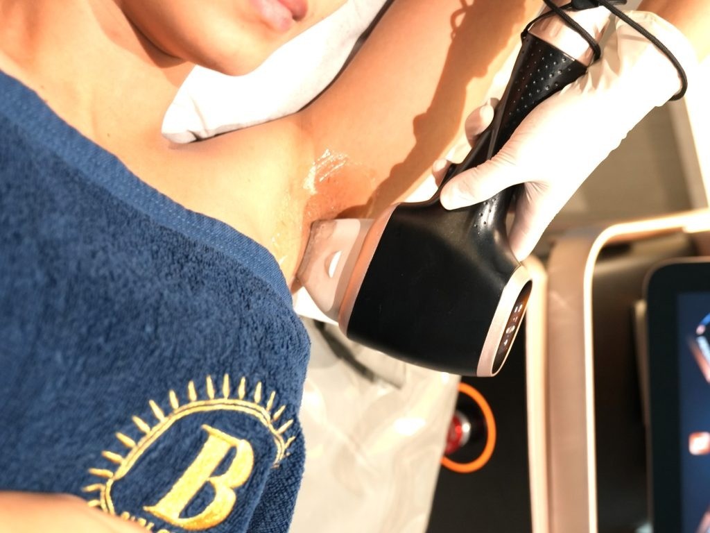 Underarm hair removal at bibiclinic